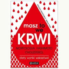 Masz to we krwi. Morfologia, Hashimoto, cholesterol. Diety, wyniki, wskazówki, 9788327126566